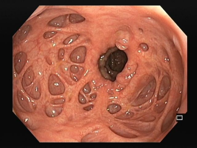 PIE 2020 - 1º Prémio - Fotografia