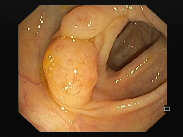 PIE 2020 - 2º Prémio - Fotografia