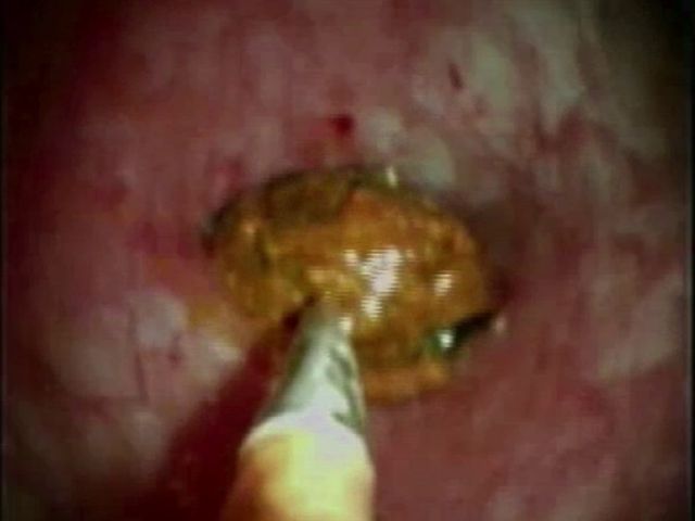 PIE 2020 - 1º Prémio - Vídeo