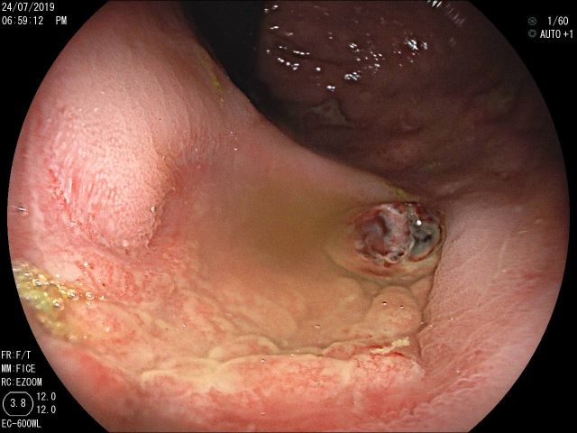 PIE 2020 - 2º Prémio - Vídeo