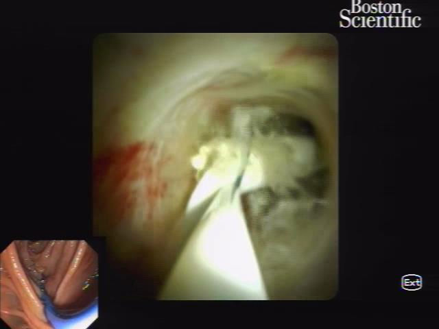 PIE 2020 - Menção Honrosa - Vídeo