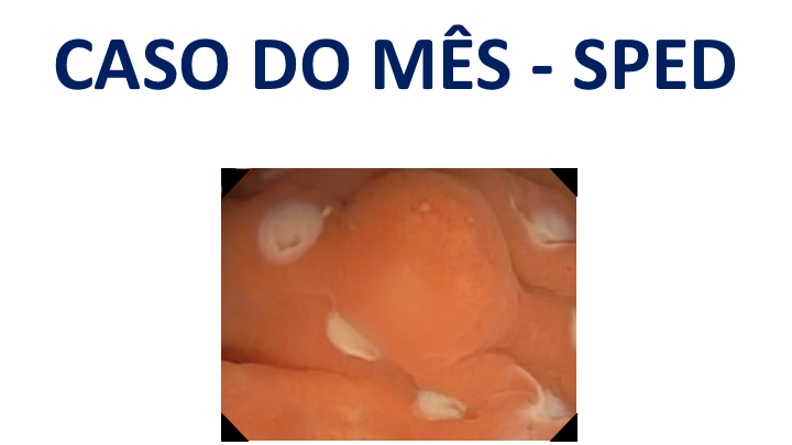 Novidade SPED! Caso clínico do mês - dezembro 2023